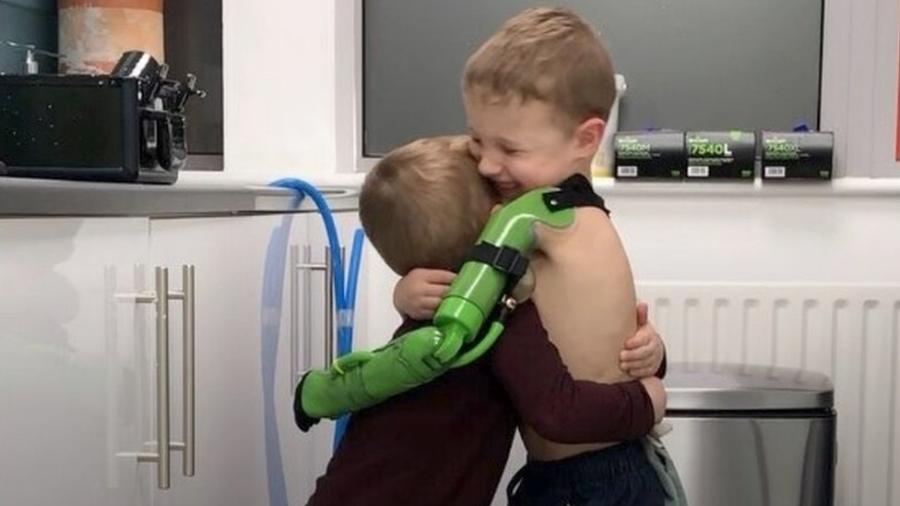 Jacob abraçou o irmão depois que recebeu a prótese - Ben Ryan