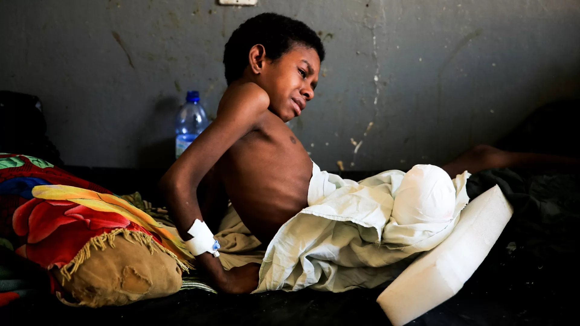 Ali Asyalo, 14, recebe tratamento após perder sua perna direita por causa de explosivos