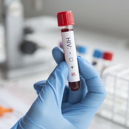 Teste HIV - Getty Images - Getty Images