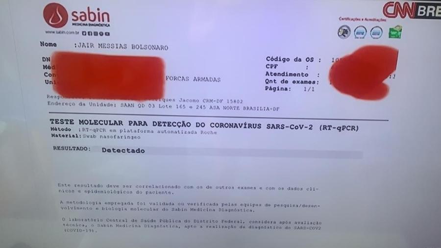 Exame do presidente Jair Bolsonaro (sem partido) que testou positivo para a covid-19 - Reprodução/CNN