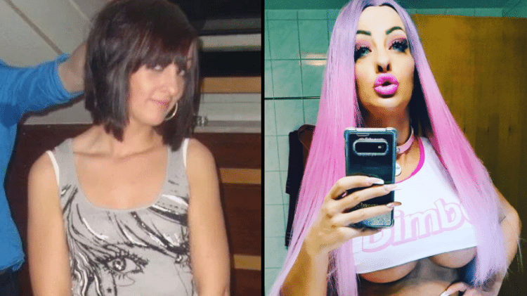 Cathy antes e depois dos procedimentos estéticos - Reprodução/Jam Press - Reprodução/Jam Press