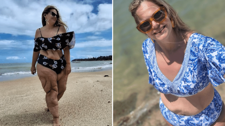 Luciane passou pela bariátrica em 2014 e perdeu mais de 60 quilos Luciane passou pela bariátrica em 2014 e perdeu mais de 60 quilos