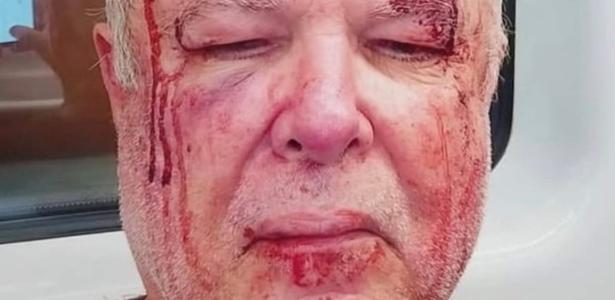 Policía investiga agresión a ancianos en Copacabana por motivación política