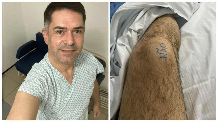 O geneticista Anderson Pontes Arruda, 50, assinalou com um grande "não" o joelho que seria poupado da cirurgia