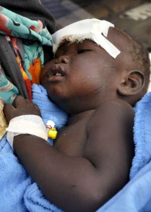 Nyloak Tong, 14 meses, sobreviveu à queda de avião no Sudão no Sul e recebe tratamento médico  - Jok Solomun/Reuters