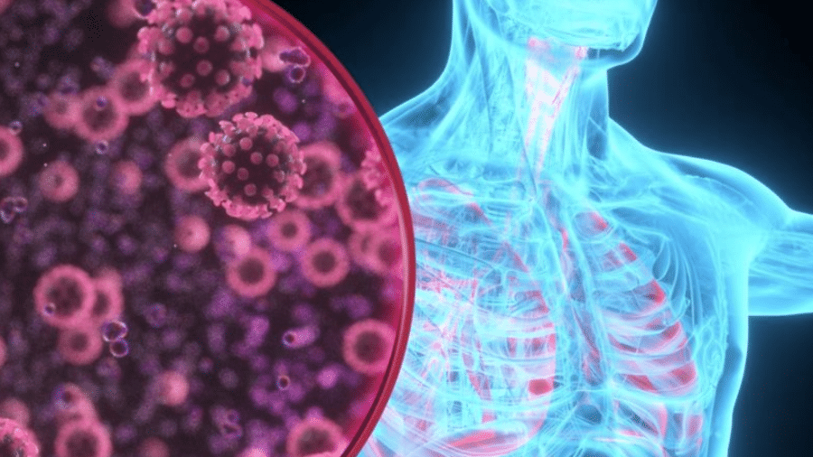 Principais alvos da covid-19 são o pulmão e as vias respiratórias, mas vírus tem surpreendido por seu variado ataque, do cérebro aos rins - Getty Images