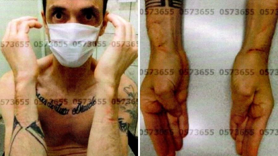 Montagem com imagens que integram o laudo de exame de corpo de delito do preso Paulo Cesar Souza Nascimento Júnior, o Paulinho Neblina - Reprodução
