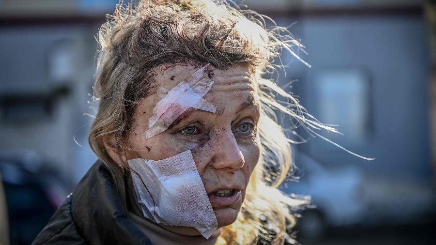 24.fev.2022 - Uma mulher ferida fica do lado de fora de um hospital após o bombardeio da cidade de Chuguiv, no leste da Ucrânia - Aris Messinis / AFP