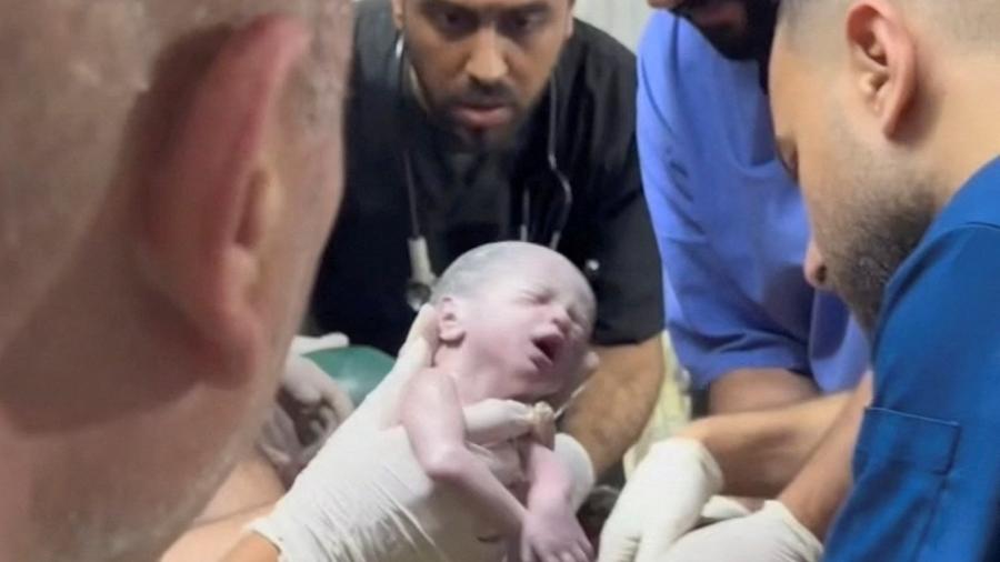 Bebê, que nasceu com 1,4 quilo, sobreviveu e está hospitalizada