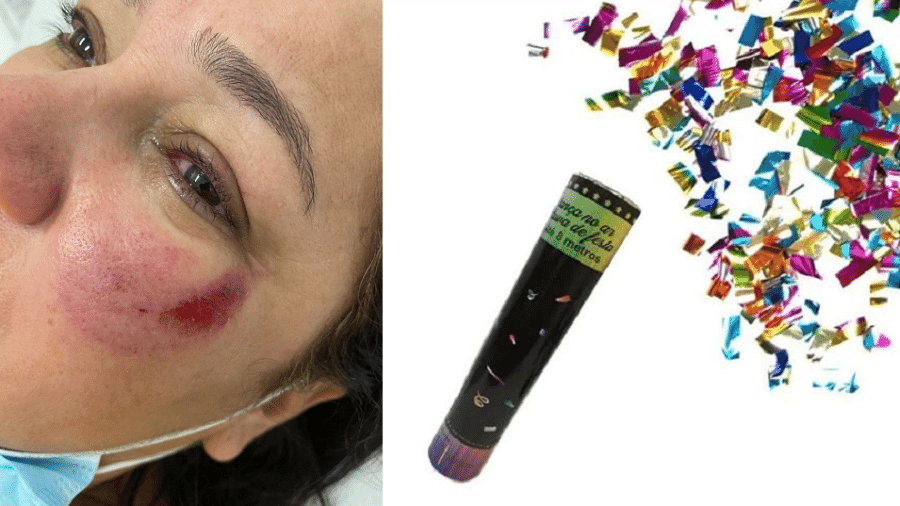 Professora Meire Castro Ribeiro foi atingida por vidro após lança confete estourar e atingir óculos, que quebraram - Facebook/Reprodução