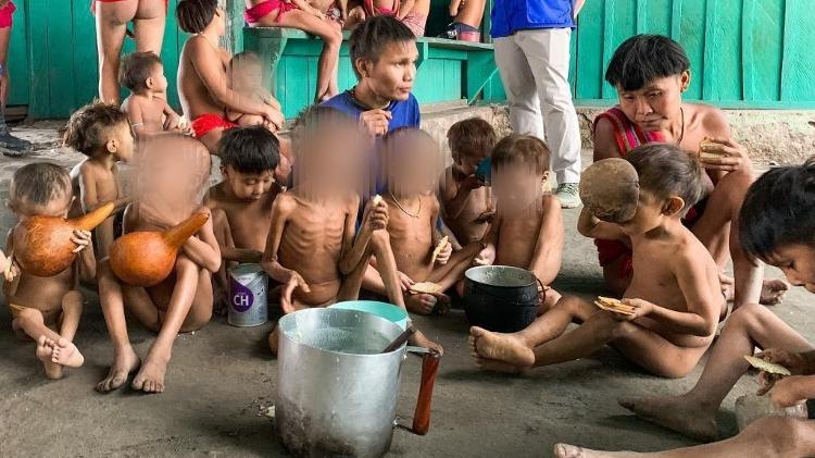 Crianças desnutridas atendidas na unidade de saúde Surucucu, na Terra Indigena Yanomami (RR)