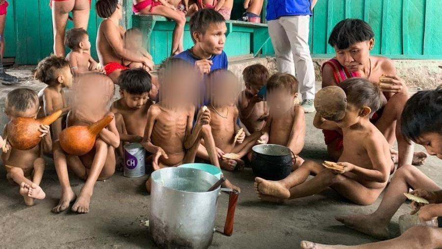 Crianças desnutridas atendidas na unidade de saúde Surucucu, na Terra Indigena Ianômami (RR) - Antonio Alvarado/@antonioalvaradoc/Urihi Associação Yanomami