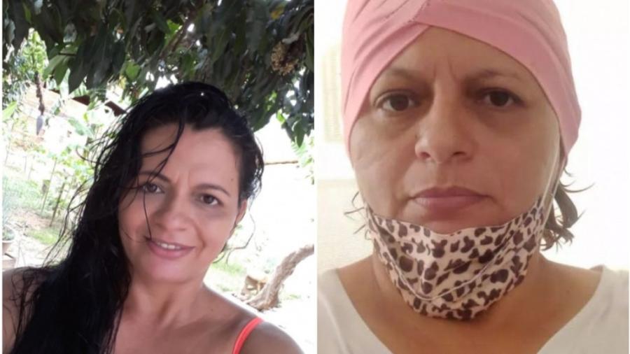 Edileny Mayre foi diagnosticada com câncer de mama após médico dizer que era gordura - Arquivo Pessoal
