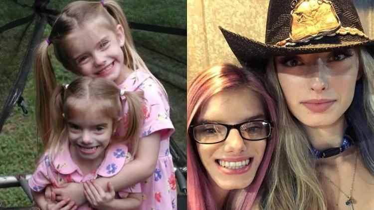 Sierra and Sienna - Disclosure/Guinness World Records - Disclosure/Guinness World Records