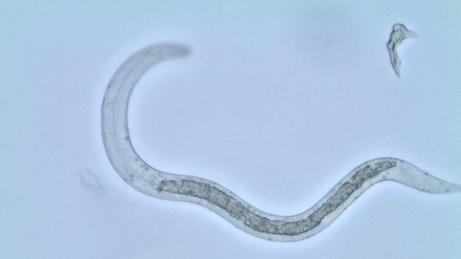 Ascaris lumbricoides, ou lombriga, que causa ascaridíase Ascaris lumbricoides, ou lombriga, que causa ascaridíase