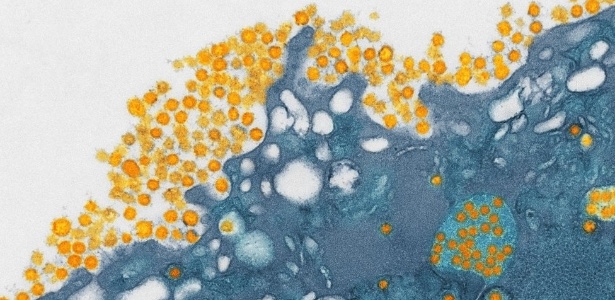 Pesquisadores poderão pesquisar vírus como o Mers, que provocou síndrome respiratória no Oriente Médio - Science Photo Library