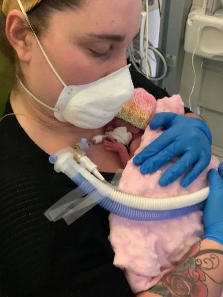 16.02.2021 -- Emily Rospo segura a filha, que nasceu com 27 semanas e apenas 490 gramas - Reprodução/Facebook