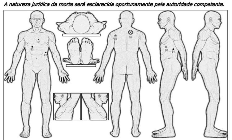 Laudo mostra disparos que atingiram Fábio Ferreira, morto na Operação Escudo