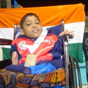 O indiano Moin Junnedi, 18, nasceu com uma doença óssea rara que o torna muito suscetível a fraturas  - Reprodução/Índia Times
