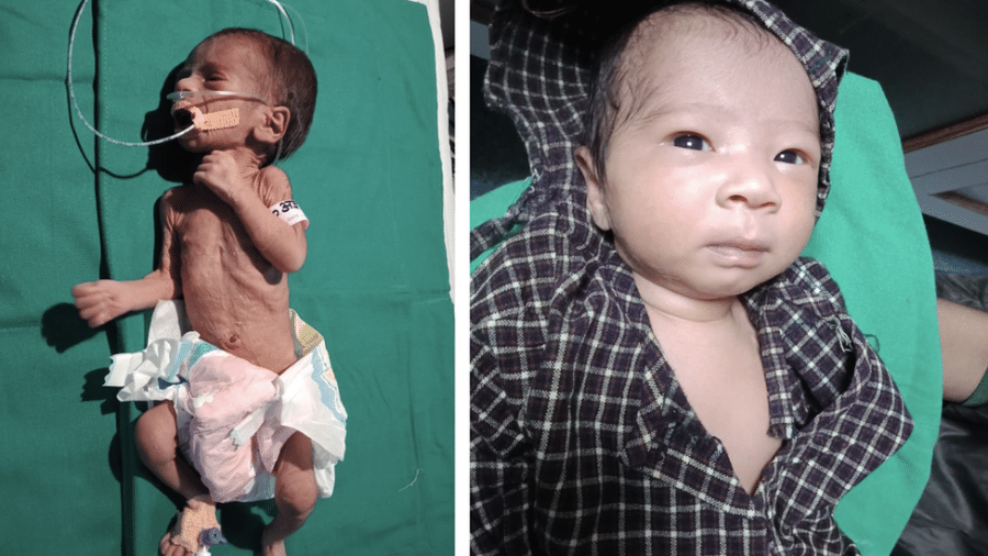 A bebê foi levada ao hospital em estado crítico em outubro, mas agora está saudável - Dr Ravi Khanna