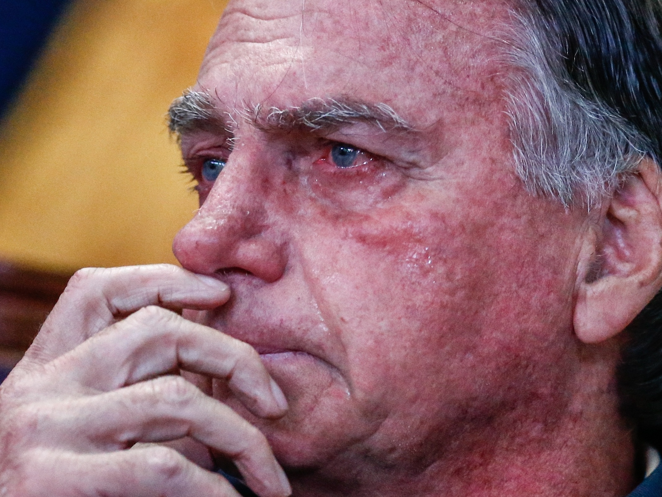 Bolsonaro teve crise 'forte' de soluços por 36 h, diz boletim médico