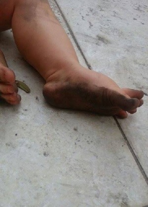 Criança suja os pés com o pó preto que as indústrias de Vitória (ES) soltam no ar - Divulgação/ Juntos - SOS ES Ambiental