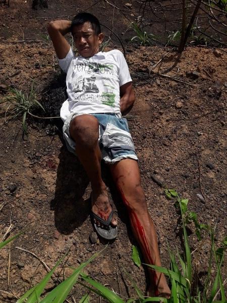 Membro da etnia guajajara é alvo de ataque a tiros no Maranhão - Arquivo pessoal