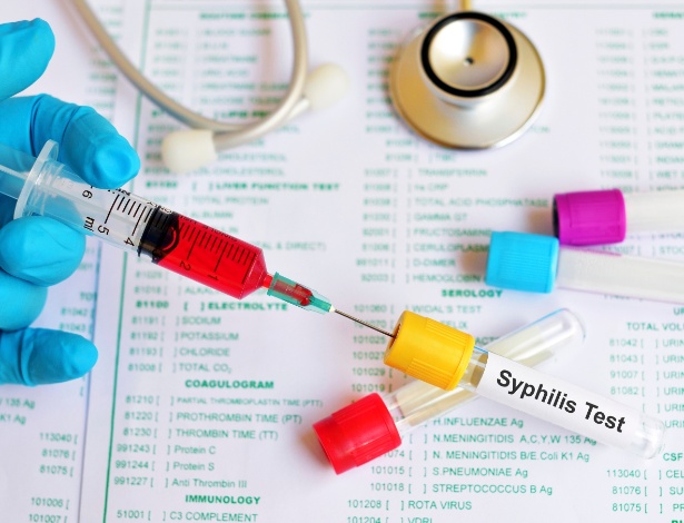 Teste de sífilis - iStock