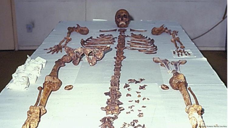 Ossos de Mengele viraram objeto de estudo na USP Ossos de Mengele viraram objeto de estudo na USP