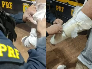 Homem é preso fingindo ter braço quebrado para transportar cocaína em gesso