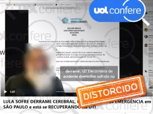 Lula teve uma hemorragia no cérebro, e não um derrame