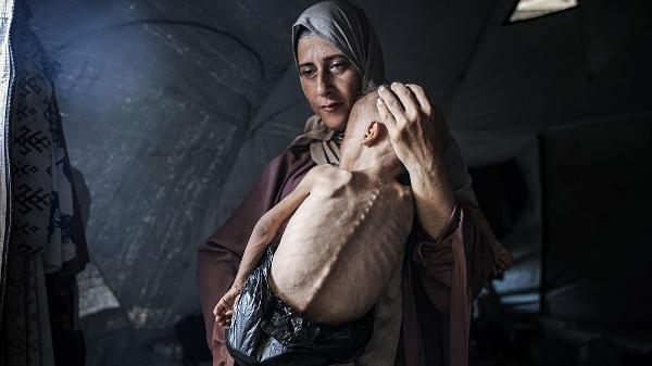 Criança de 1 ano e meio no colo da mãe na Cidade de Gaza Criança de 1 ano e meio no colo da mãe na Cidade de Gaza
