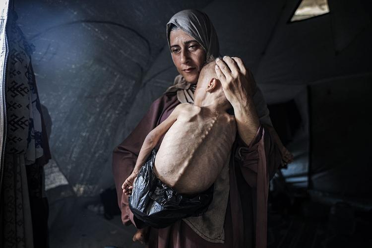 21.jul.2025 - Criança de 1 ano e meio no colo da mãe na Cidade de Gaza