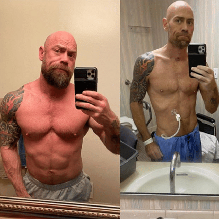 O enfermeiro Mike Schultz com fotos de antes e depois da covid-19 - Reprodução/Instagram