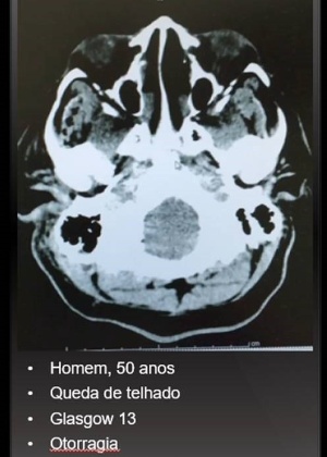 Informações básicas e imagem a Tomografia Computadorizada enviadas aos cinco médicos avaliadores via WhatsApp - Luiz Adriano Esteves/Reprodução - Luiz Adriano Esteves/Reprodução