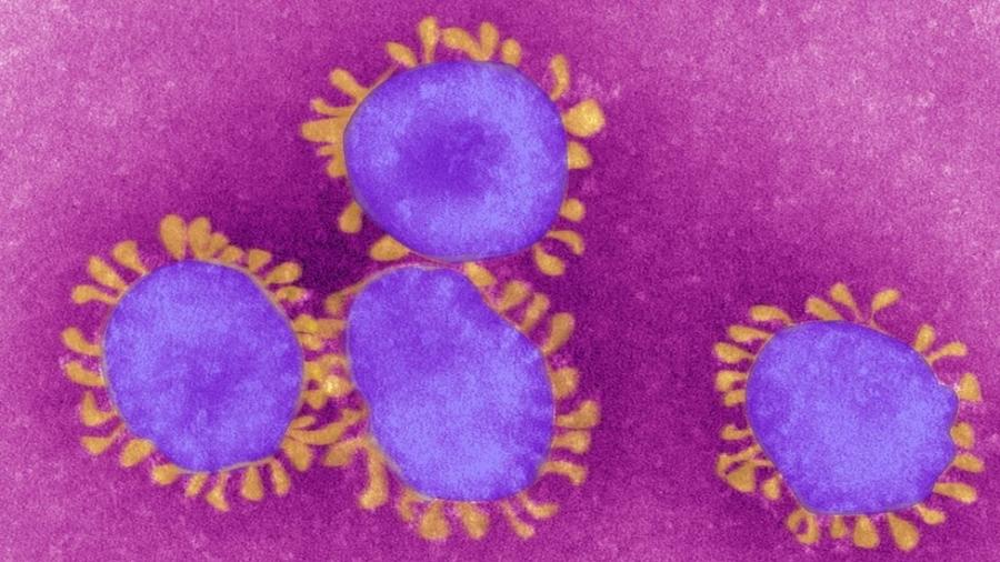 O termo "pandemia" é usado para descrever situações em que uma doença infecciosa ameaça muitas pessoas de forma simultânea no mundo inteiro - BSIP