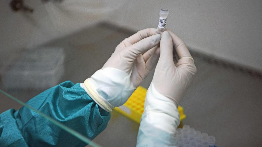 Demanda alta por testes tem feito com que eles passem a faltar ou a ficar limitados em farmácias e laboratórios - Carl de Souza/AFP