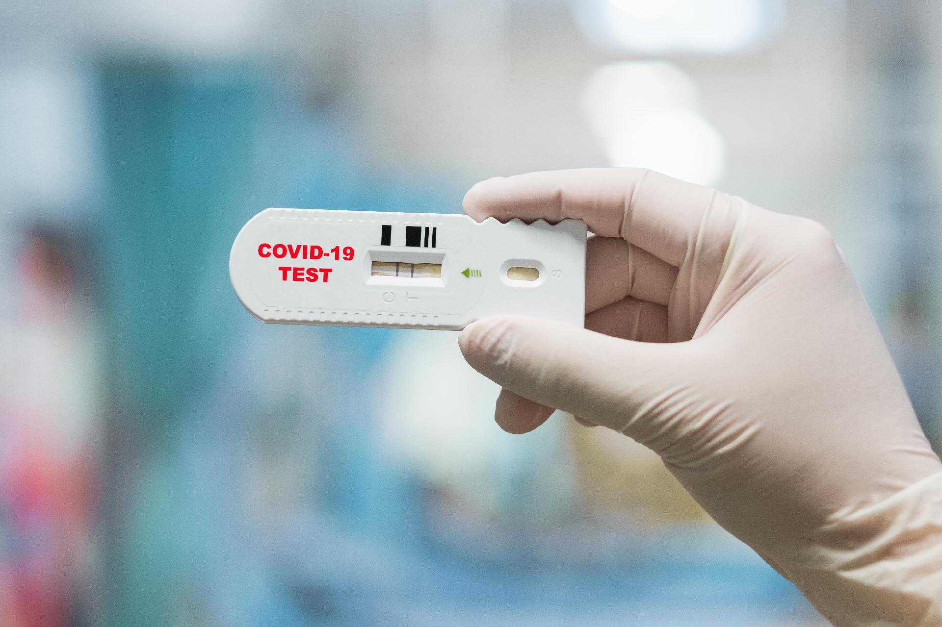 Coronavirus Israelenses Criam Teste Caseiro Para Covid 19 Com Resultado Em Menos De 1h