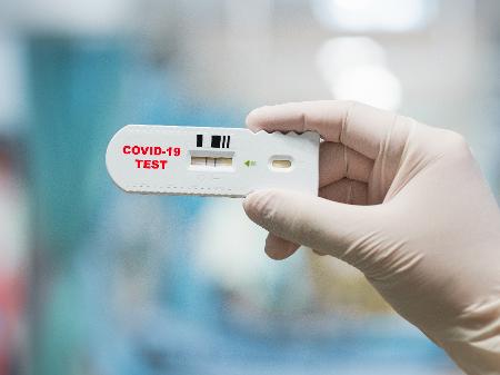Coronavírus: Anvisa aprova teste rápido de empresa italiana - 03 ...