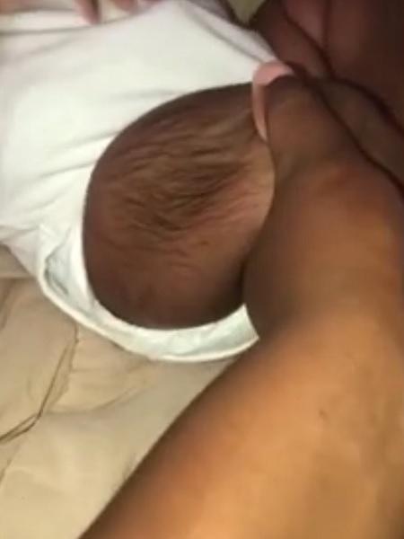 Imagem da perna do bebê com o corpo coberto de pelos - Divulgação