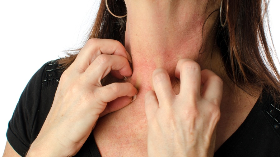 Sintomas podem variar de coceira ou náusea a inchaço, dificuldades respiratórias e anafilaxia Sintomas podem variar de coceira ou náusea a inchaço, dificuldades respiratórias e anafilaxia