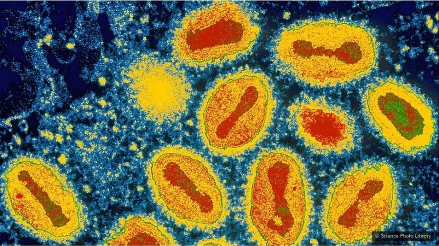 Além do Sars, apenas dois outros vírus foram levados à extinção propositalmente: varíola e peste bovina - Science Photo Library