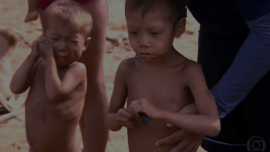 Crianças yanomamis, com desnutrição e malária - Reprodução Fantástico