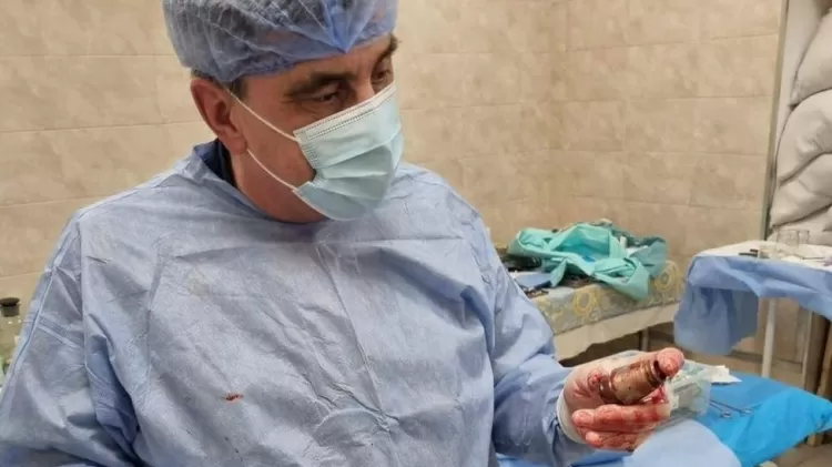 Cirurgião Andriy Verba examina a granada após a operação - Hanna Maliar Facebook - Hanna Maliar Facebook