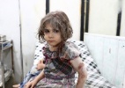 Crianças são as maiores vítimas da guerra civil na Síria - Abd Doumany/AFP