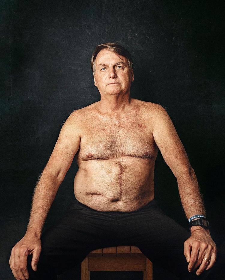 Bolsonaro Aparece Sem Camisa E Com Cicatriz Mostra