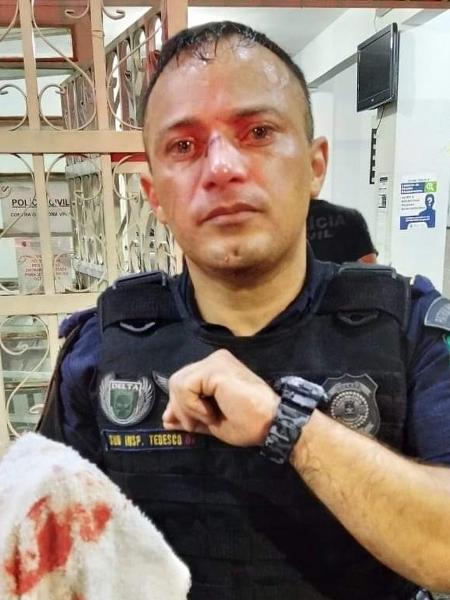 Subinspetor da GCM de Carapicuíba teve o nariz fraturado durante conflito na ação - Divulgação/Prefeitura de Carapicuíba