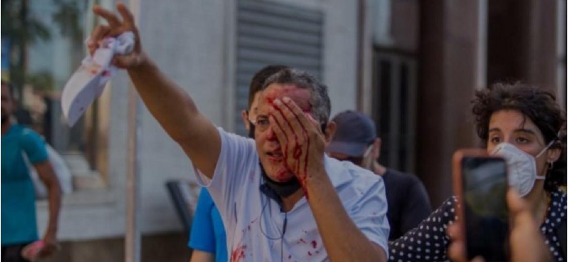 Homem é ferido no olho pela PM de Pernambuco - Reprodução
