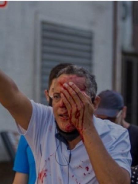 Homem é ferido no olho pela PM de Pernambuco - Reprodução