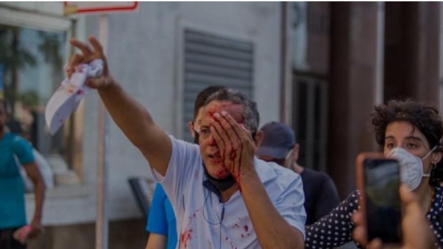 Homem é ferido no olho, em Recife, por bala de borracha disparada pela PM de Pernambuco. Truculência têm de ser investigada e punida - Reprodução